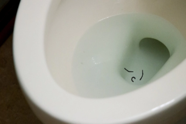 Worms in Toilet: Here's What's Going On